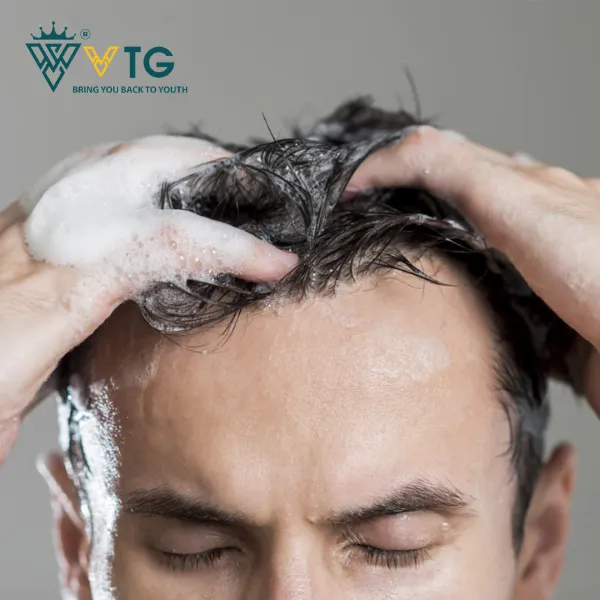 Làm sạch da đầu giúp keo dán tóc giả bám chặt và lâu hơn