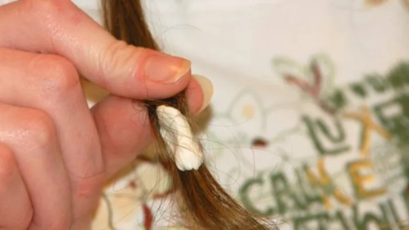 Ảnh mô tả nguyên nhân kẹo cao su dính vào tóc và những ảnh hưởng