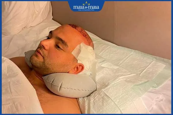 Chế độ nghỉ ngơi và dinh dưỡng giúp nang tóc phục hồi nhanh chóng