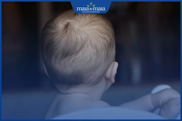 Trẻ sơ sinh nằm ngửa trên gối có thể gây rụng tóc vành khăn do ma sát.