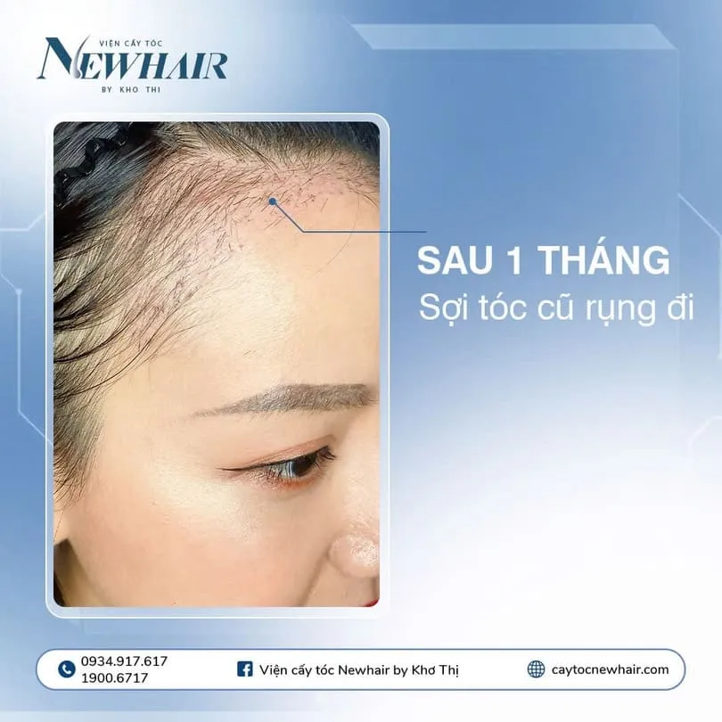 Quy trình sấy khô tóc bị rụng một cách an toàn để tránh gãy rụng