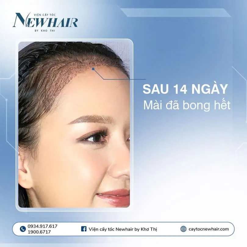 Phương pháp gội đầu nhẹ nhàng đúng chuẩn chuyên gia cho tóc bị rụng