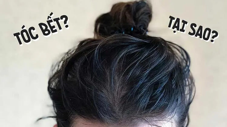 Kỹ thuật viên đang tiến hành kiểm tra và soi da đầu bằng thiết bị chuyên dụng tại trung tâm