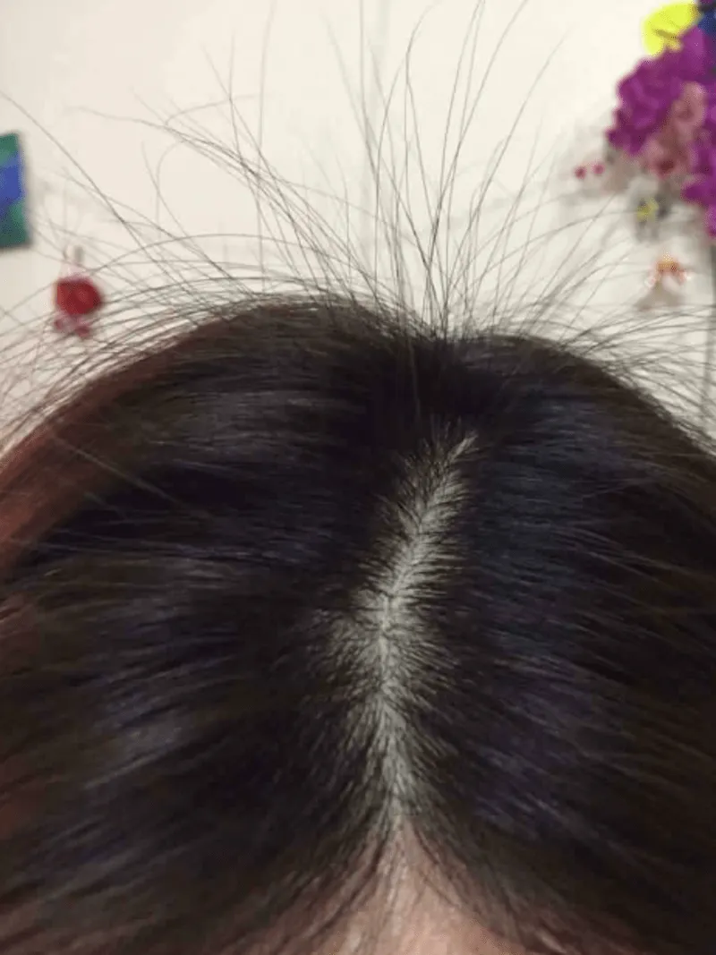 Xử lý tóc con lởm chởm, hướng dẫn cách xử lý tóc con