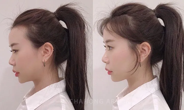 Buộc tóc đuôi ngựa lỏng cho tóc duỗi để giảm áp lực và ngăn ngừa gãy tóc