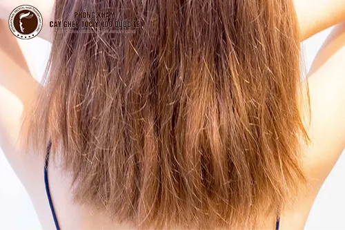 Mái tóc khô xơ, chẻ ngọn là dấu hiệu cảnh báo tóc đang thiếu dưỡng chất nghiêm trọng và cần được chăm sóc chuyên sâu