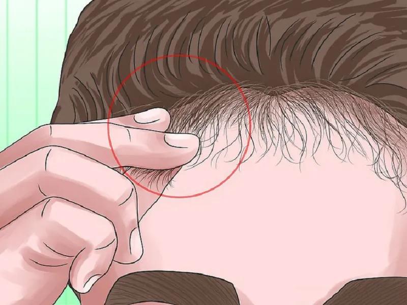 Hình ảnh khắc phục và điều trị tóc mái khô xơ, xoăn rối