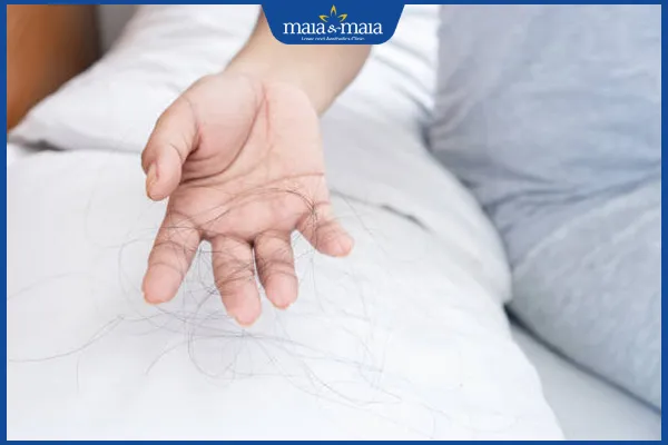 Tóc rụng trên gối, dấu hiệu rụng tóc nhiều cần có cách làm hết rụng tóc