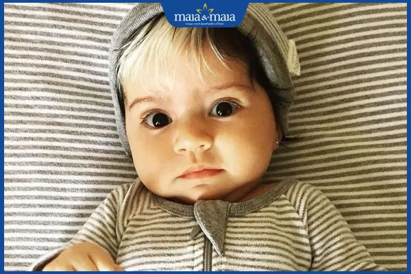 Trẻ sơ sinh hoặc trẻ nhỏ bị bạc tóc sớm cần được bác sĩ chuyên khoa đánh giá và theo dõi