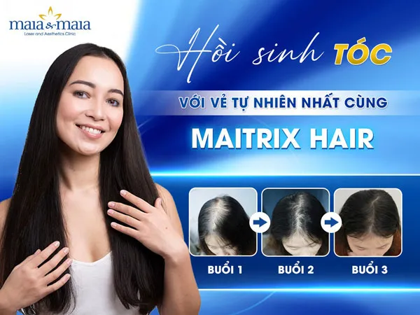 Điều trị bằng công nghệ cao Maitrix Hair là giải pháp triệt để thay vì áp dụng cách nhổ tóc sâu