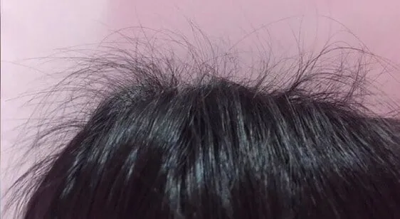 Tóc con mọc nhiều trên da đầu, vấn đề về cách xử lý tóc con